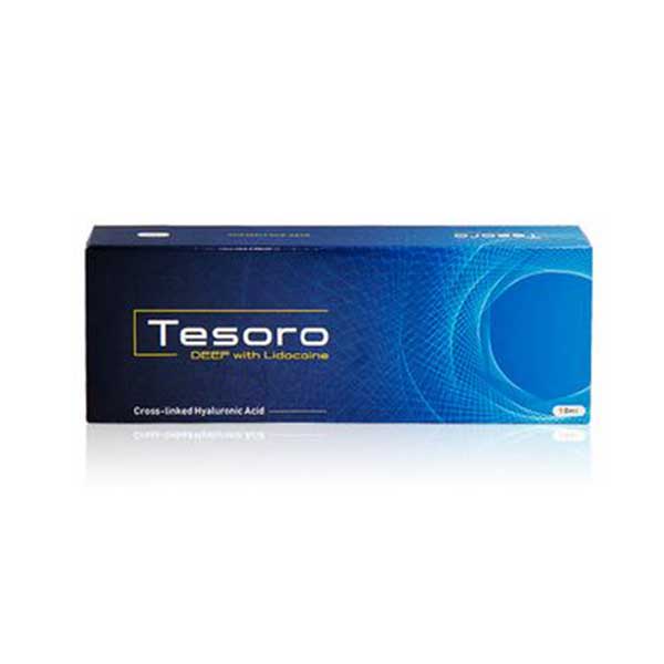 Tesero